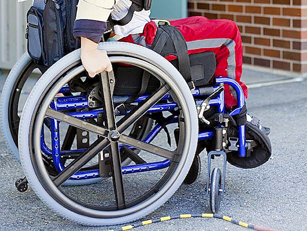 A victim of polio (Courtesy photo)