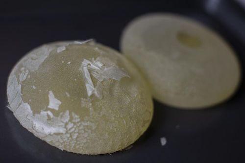 Allergan has issued a global recall of breast implants linked to a rare cancer. (Courtesy of ABC News-Go.com)