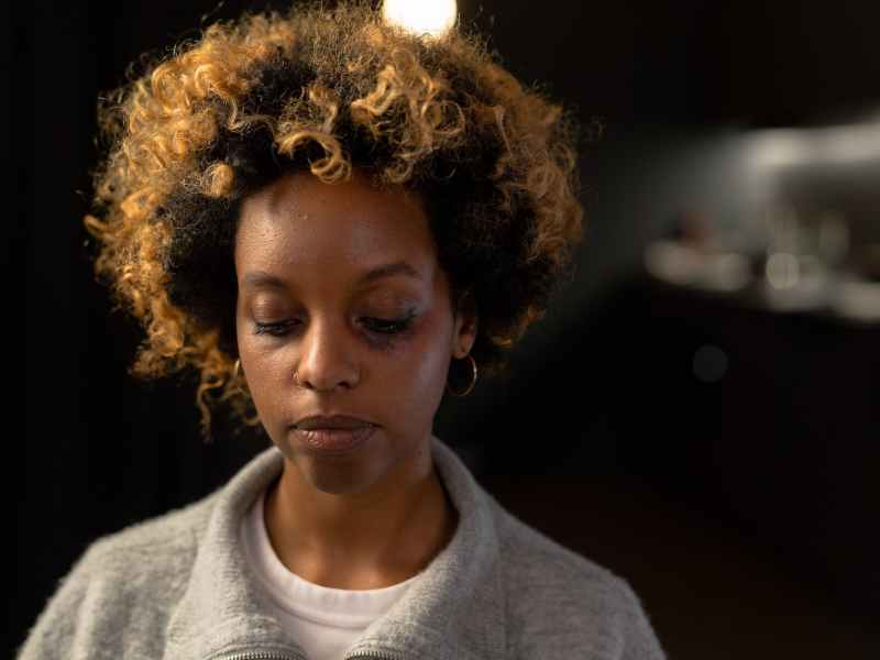 a woman with black eye